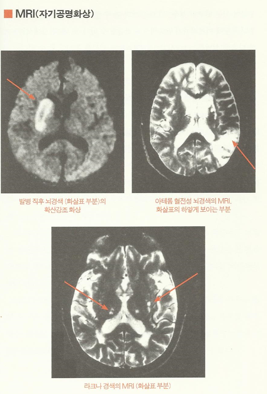 뇌11.png