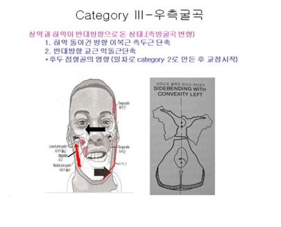 안면비-5.png