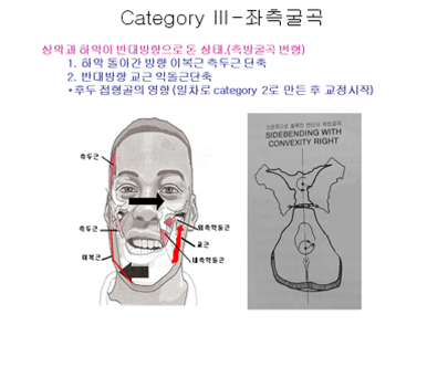 안면비-6.png