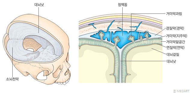 두개경막ody_190_3.jpg